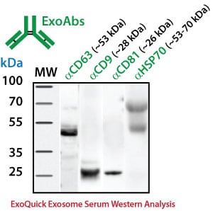 exoab_western