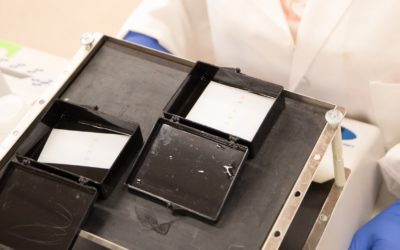 Researcher in the lab working on western blot