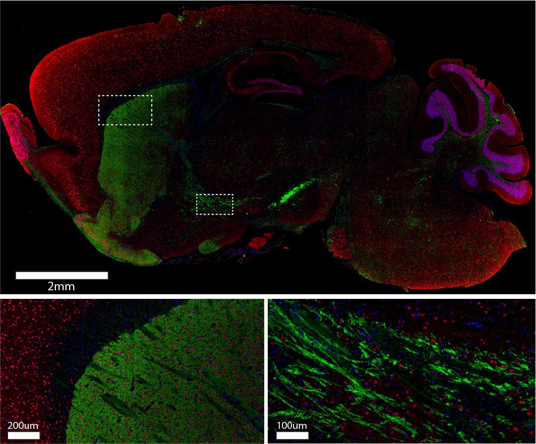 Brain-IF-multilabel-single-dilution-edit