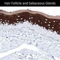 Genete Skin and Skin Cancers 1