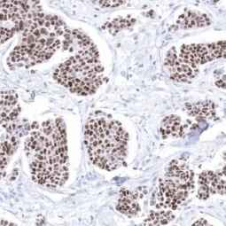 Genetex Breast Cancer 2