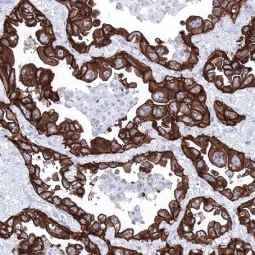 Genetex Lung Cancer 2