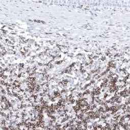 Genetex Normal Tonsil 2