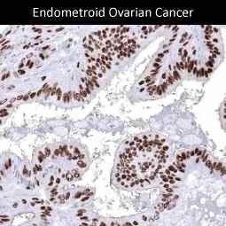 Genetex Renal Cell Carcinoma 2