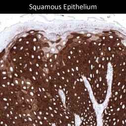 Genetex Skin and Skin Cancers 2