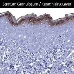 Genetex Skin and Skin Cancers 4