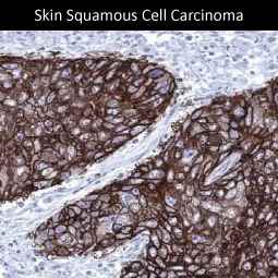 Genetex Skin and Skin Cancers 5