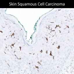 Genetex Skin and Skin Cancers 6
