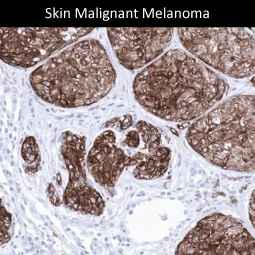Genetex Skin and Skin Cancers 7