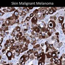 Genetex Skin and Skin Cancers 9