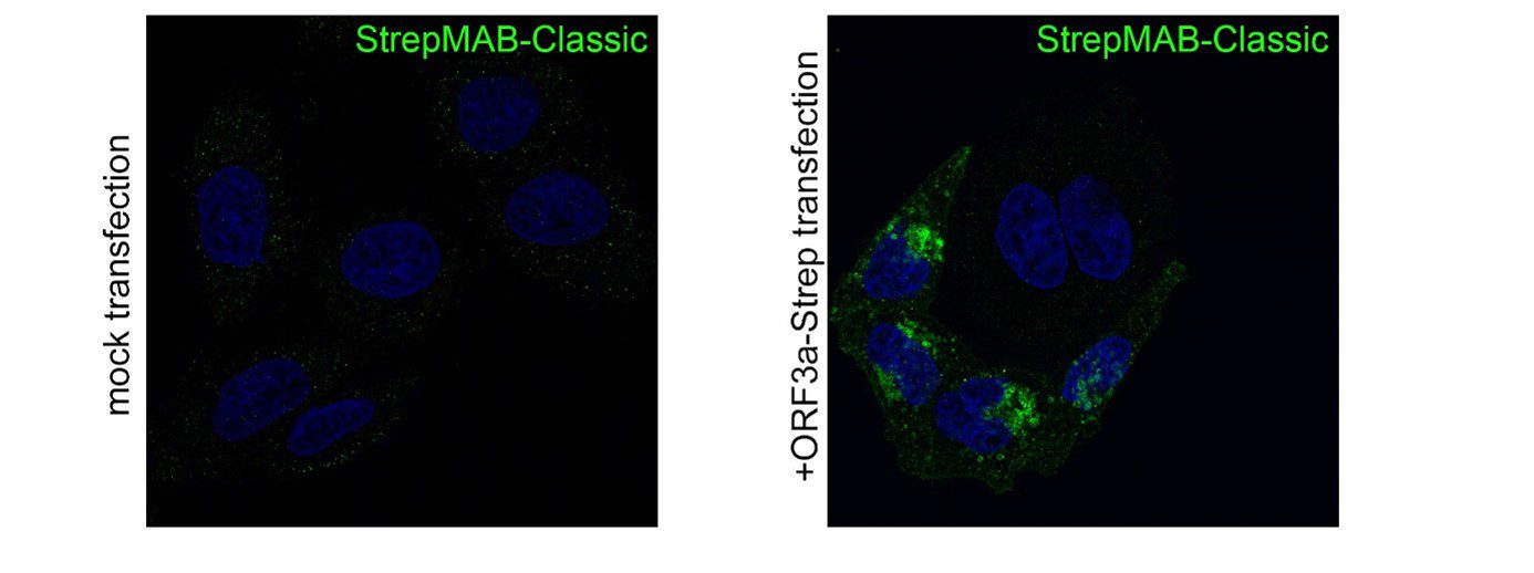 strepmab-classic (1)